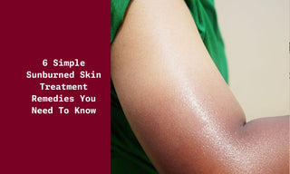6 Simple Sunburned Skin Treatment Remedies You Need to Know