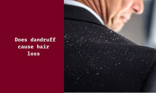 Does dandruff cause hair loss