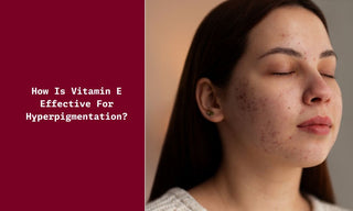 How is Vitamin E effective for Hyperpigmentation?