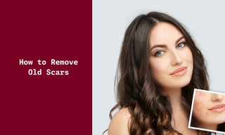 How to Remove Old Scars