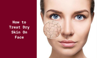 How to Treat Dry Skin On Face