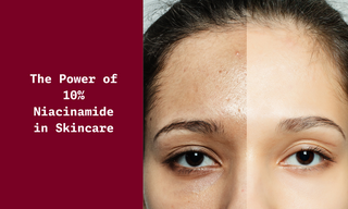 The Power of 10% Niacinamide in Skincare
