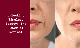 Unlocking Timeless Beauty: The Power of Retinol