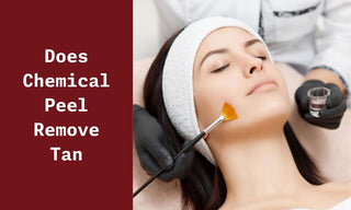 Does Chemical Peel Remove Tan? Unveiling The Truth