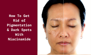 How To Get Rid of Pigmentation & Dark Spots With Niacinamide?
