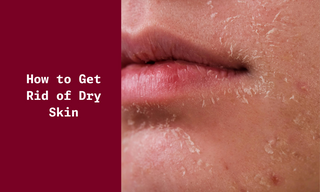 How to Prevent Dry Skin