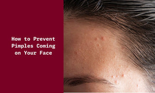 How to Prevent Pimples Coming on Your Face?