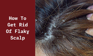 How to Get Rid of Flaky Scalp