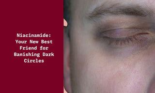 Niacinamide Your New Best Friend for Banishing Dark Circles