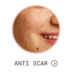 Anti scar