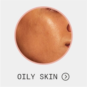 Oily Skin