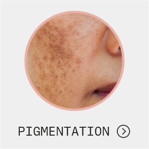 Pigmentation